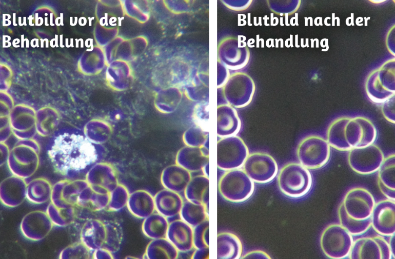 Dunkelfeld-Analyse: Ein Blutstropfen als Beweis